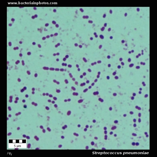Streptococcus pneumoniae under microscope microscopy of Grampositive